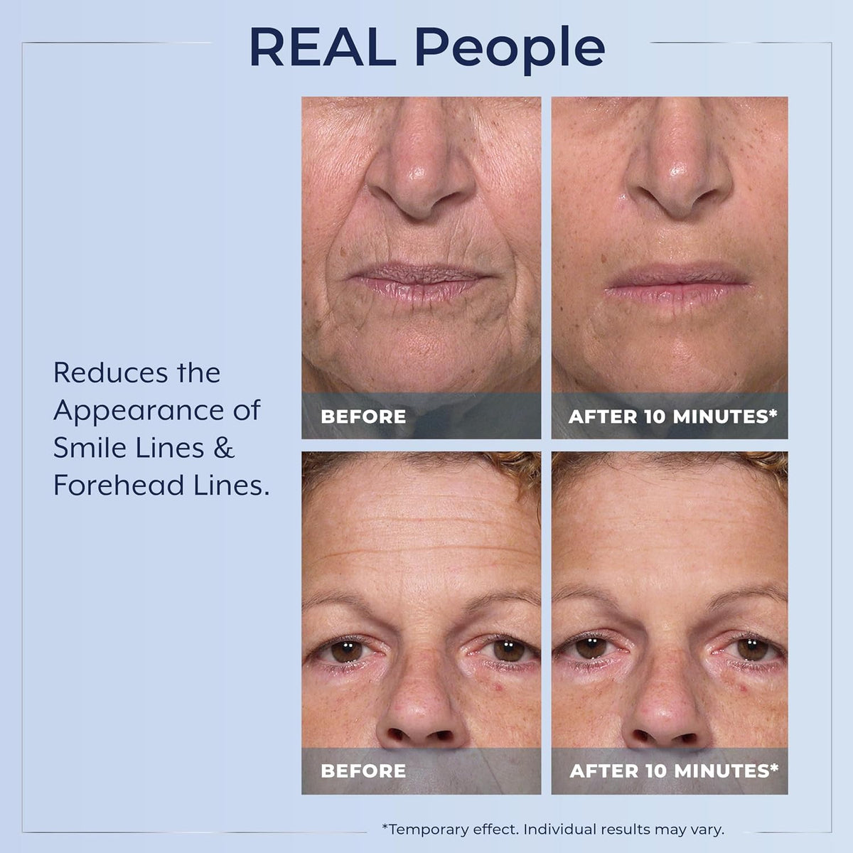 Plexaderm Rapid Reduction Serum